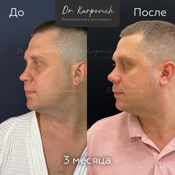 До и после. . Доктор Сергей Карпович